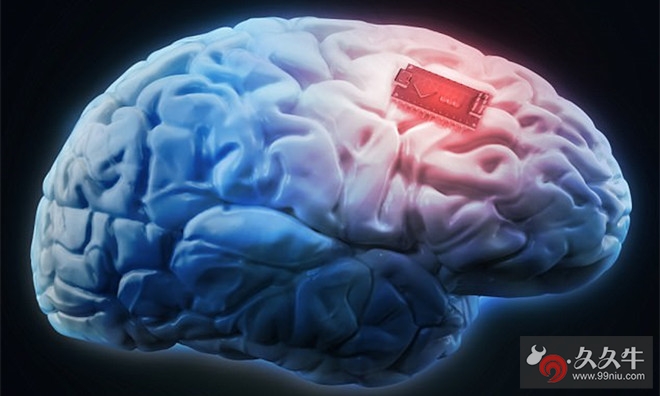 马斯克计划在人脑中植入电极以便与电脑直接交流